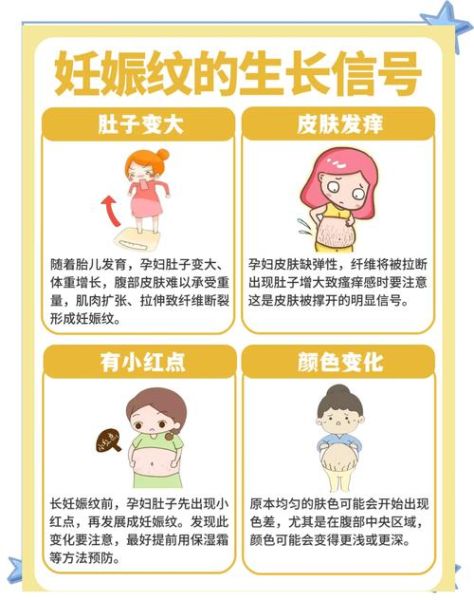 孕妇妊辰纹怎么预防_妊辰纹什么时候开始长-第3张图片-星辰妙记