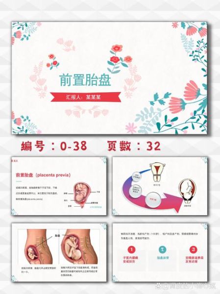 前置胎盘是什么原因引起的_孕妇前置胎盘怎么办-第1张图片-星辰妙记
