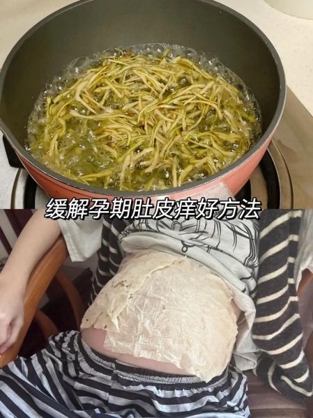 孕妇痒怎么办_孕妇身上痒怎么缓解-第1张图片-星辰妙记