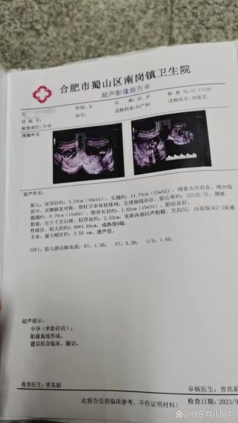 孕妇脉络丛囊肿概率_对胎儿有影响吗-第1张图片-星辰妙记