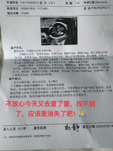 孕妇脉络丛囊肿概率_对胎儿有影响吗-第2张图片-星辰妙记