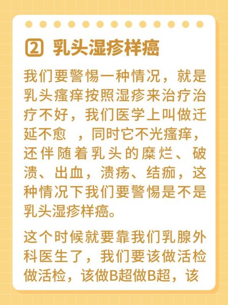 孕妇乳头痒怎么办_孕妇乳头痒是什么原因-第3张图片-星辰妙记