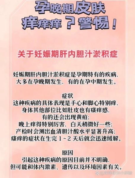 孕妇胆汁淤积是哪里痒_胆汁淤积瘙痒部位图解-第2张图片-星辰妙记