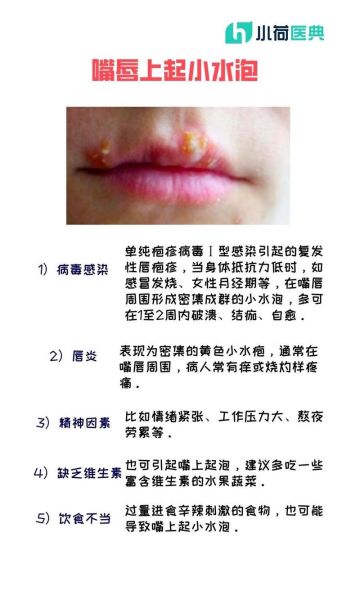 孕妇嘴角长疱疹怎么办_会影响胎儿吗-第1张图片-星辰妙记