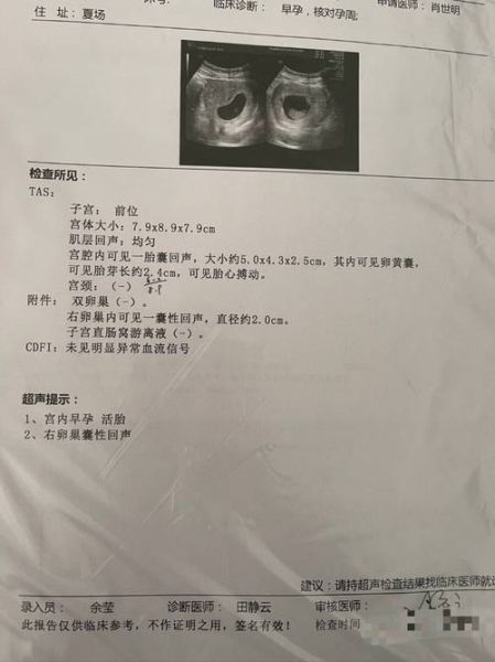 孕妇b超需要空腹吗_孕早期b超注意事项-第2张图片-星辰妙记