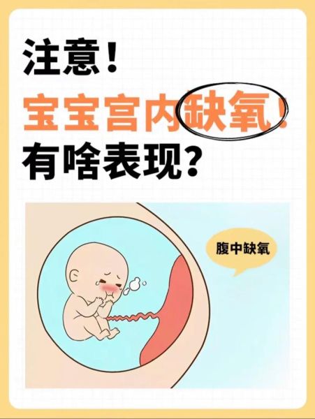 孕晚期胎儿缺氧孕妇会有什么反应_胎儿缺氧孕妇症状-第1张图片-星辰妙记