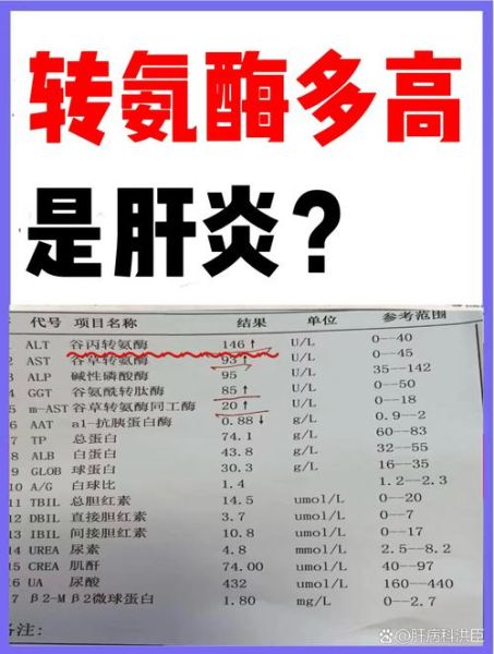 孕妇谷丙转氨酶偏高是什么原因_怎么办-第2张图片-星辰妙记