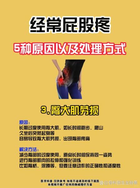 孕妇屁股疼是怎么回事_如何缓解孕晚期臀部酸痛-第3张图片-星辰妙记