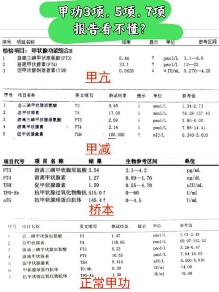 孕妇甲状腺检查几周做_甲功异常对胎儿影响-第1张图片-星辰妙记