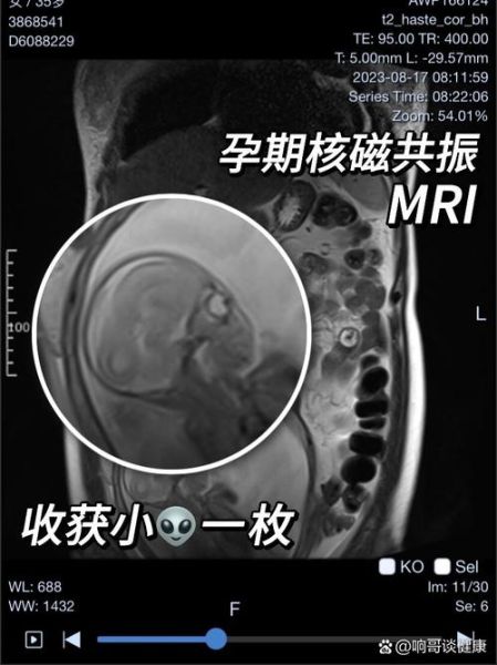 孕妇可以做核磁共振吗_对胎儿有影响吗-第1张图片-星辰妙记 孕妇可以做核磁共振吗_对胎儿有影响吗-第1张图片-星辰妙记