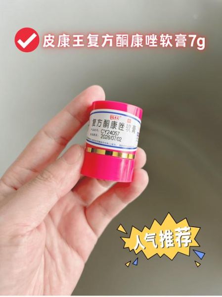 孕妇长癣可以用什么药膏_对胎儿有影响吗-第1张图片-星辰妙记 孕妇长癣可以用什么药膏_对胎儿有影响吗-第1张图片-星辰妙记