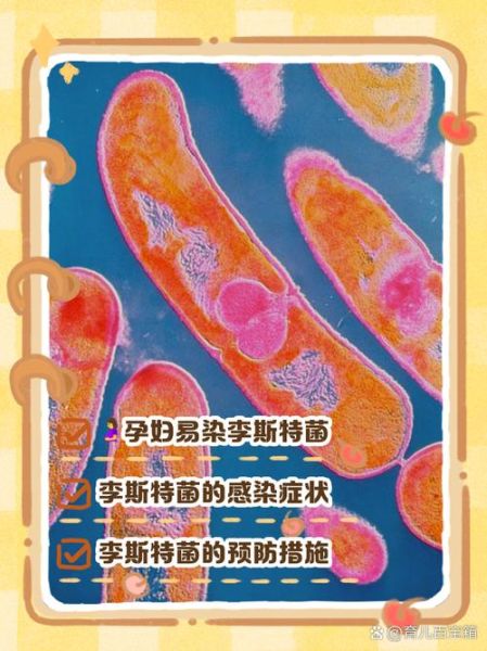 孕妇感染李斯特菌胎儿还有救吗_李斯特菌感染胎儿存活率-第2张图片-星辰妙记