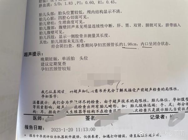 宫颈短孕妇如何保胎_宫颈短保胎方法有哪些-第2张图片-星辰妙记