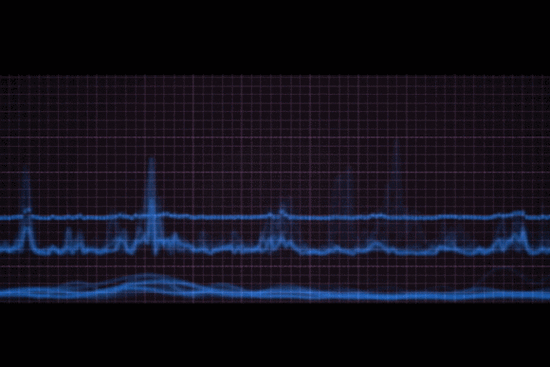 孕妇可以做动态心电图吗_对胎儿有没有影响-第1张图片-星辰妙记