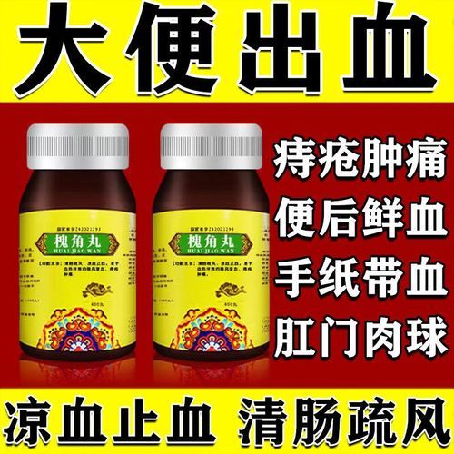 孕妇痔疮出血了怎么办_孕妇痔疮出血能用什么药-第1张图片-星辰妙记 孕妇痔疮出血了怎么办_孕妇痔疮出血能用什么药-第1张图片-星辰妙记