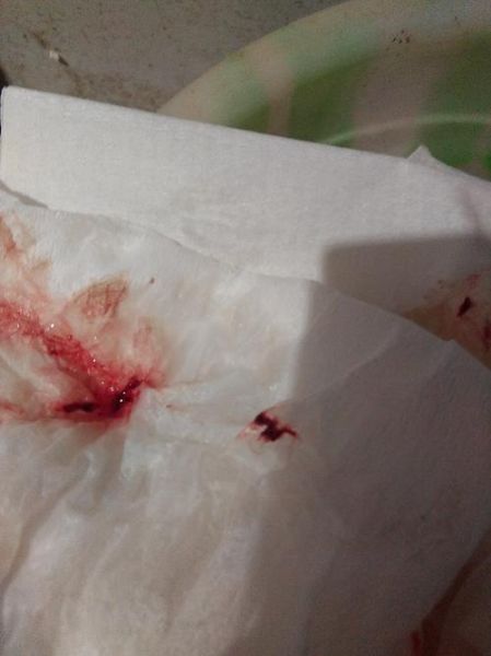 孕妇见红后多久会生_临产见红图片真实表现-第2张图片-星辰妙记