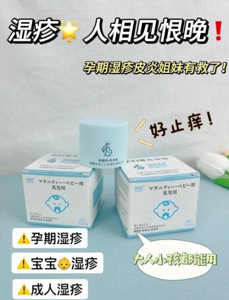 孕妇湿疹对胎儿有影响吗_孕妇湿疹怎么缓解-第1张图片-星辰妙记