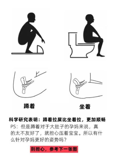 孕妇便秘严重怎么办_快速通便方法-第3张图片-星辰妙记